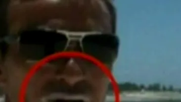 VIDEO Oare ce a patit Radu Mazare? Am bagat botul unde nu trebuie!