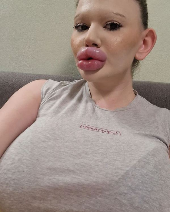 Andrea Emilova Ivanova este decisă să își facă intervenții estetice noi în iarnă. Sursă foto: Instagram