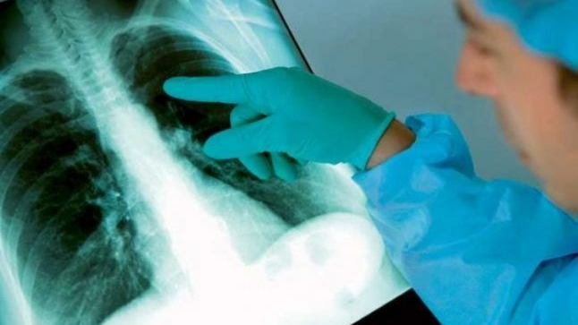 Cazuri de tuberculoză în Brăila! 120 de elevi și 30 de profesori au…