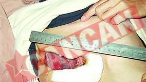 A trait zece ani cu o gaura in piept