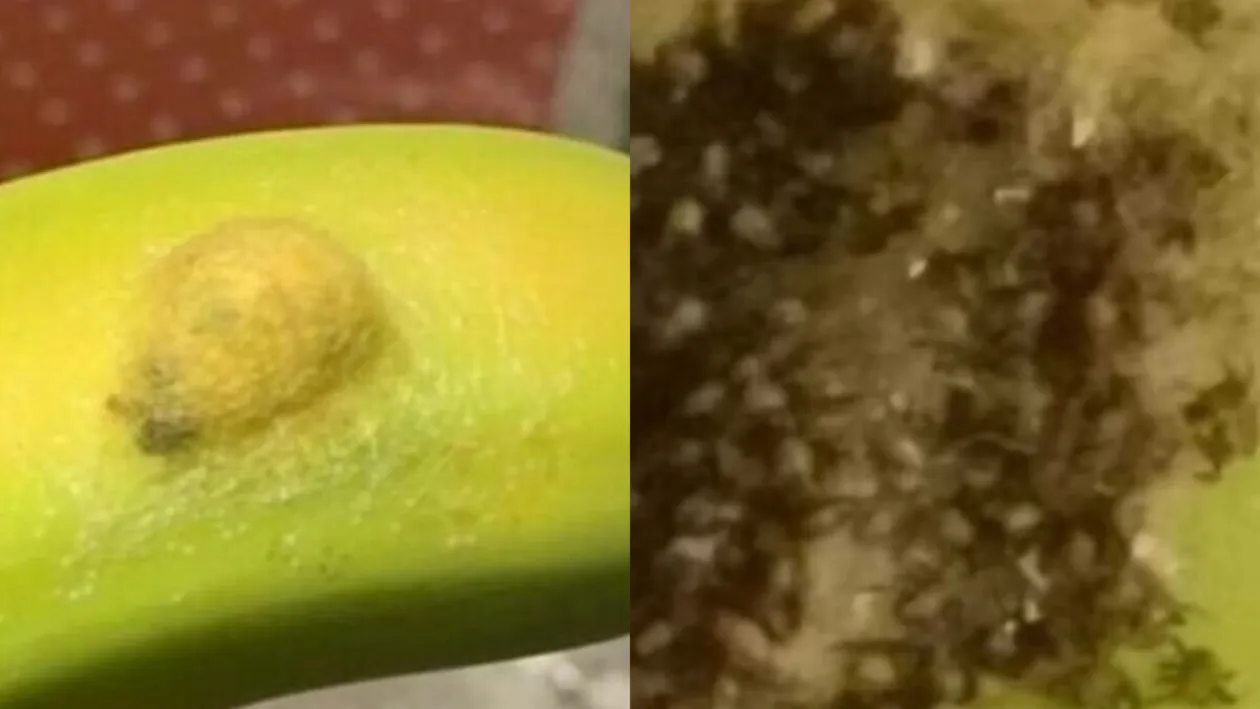 Dezgustător! Ce a descoperit o femeie sub coaja unei banane: ”Am simțit mâncărimi peste tot”