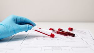 El este pacientul „zero”, care a adus lepra în Europa! De la el a pornit totul, iar autoritățile ar fi mușamalizat cazul