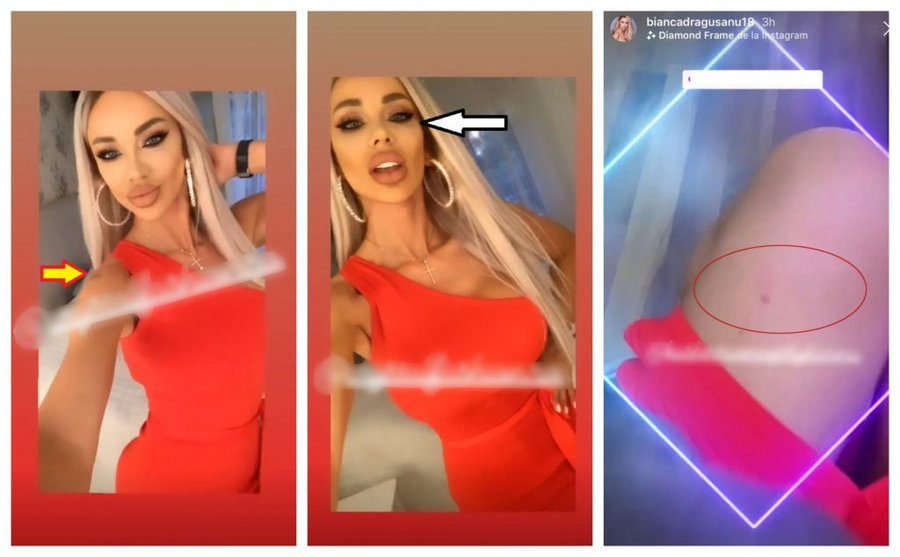 Aceste imagini cu Bianca Drăgușanu au fost realizate la câteva ore după ce a fost agresată de soțul ei © Instagram Stories 