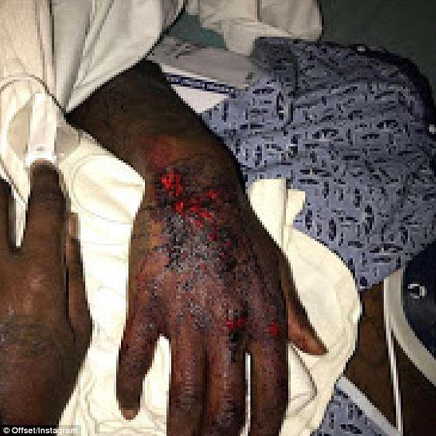 GALERIE FOTO. Cum arată Offset, logodnicul lui Cardi B, după ce și-a făcut praf bolidul de 80.000 de dolari. „Puteam fi mort!”