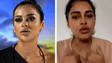 Ema Oprișan, surprinsă cu ochiul bandajat. Ce a pățit fosta concurentă de la Insula iubirii