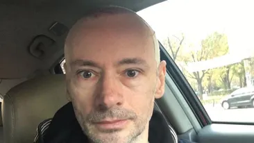 MIHAI ALBU, probleme în urma implantului de păr? Designerul a mărturisit:,,E buba PE cap’’