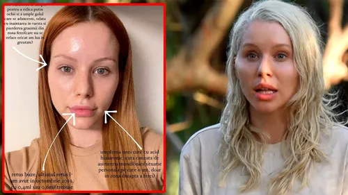 Cum arăta Carmen Grebenișan de la Survivor 2023, înainte să își facă operațiile estetice. Blonda de la Pro TV zici că-i alt om!