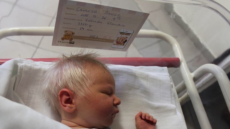 Un bebeluş s-a născut cu părul alb! Părinţii au rămas fără cuvinte când au auzit motivul