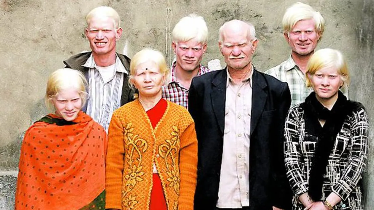 Cel mai mare clan de albinosi din lume. Va vine sa credeti ca sunt indieni?