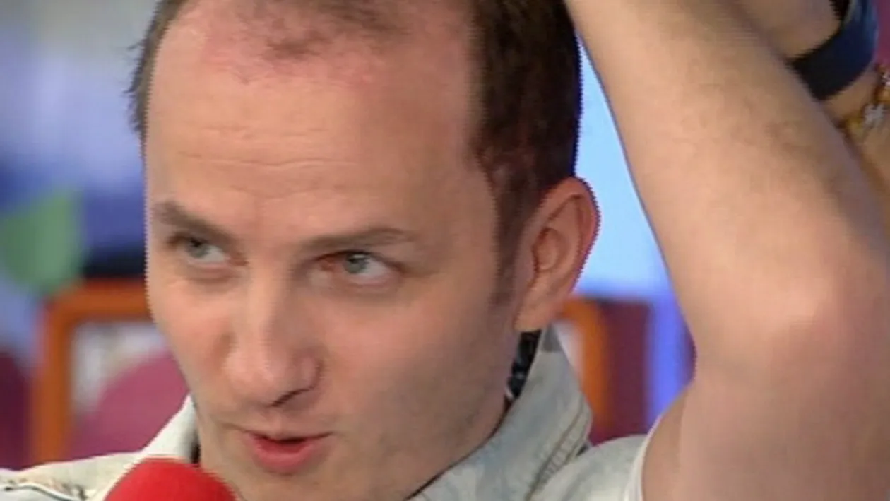 Medicul care l-a operat pe Razvan Ciobanu, despre implantul de par suferit de Mihai Traistariu: Ceva nu e in regula