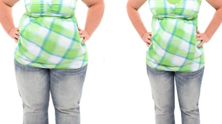 Solutia chirurgicala pentru grasimea nedorita de pe fese, abdomen, genunchi, solduri si talie! Tot ce trebuie sa stii despre liposuctie