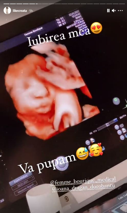 Like Creața de la Chefi la Cuțite a dezvăluit când naște: “Vine pe lume mai devreme, dar tot în termen” + primele ecografii cu fetița