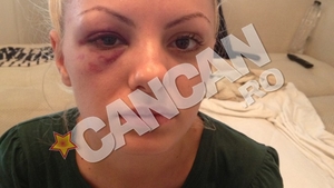 Alexandra Stan, despre cosmarul provocat de manager: “M-a batut pana am lesinat, apoi m-a aruncat din masina, plina de sange!”