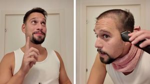 Vlad Gherman a apărut în public după cele 2 implanturi de păr. Cum arată acum