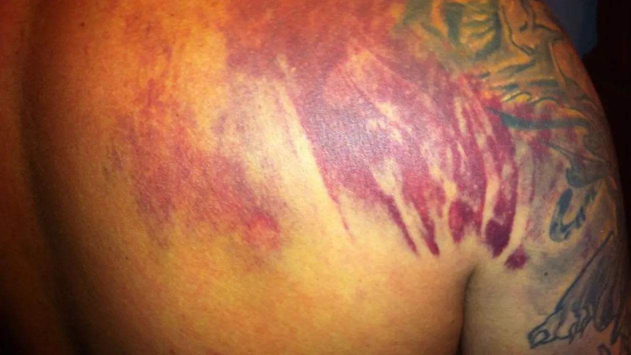 Un sofer de microbuz acuza ca a fost desfigurat de politisti si jandarmi intr-o benzinarie din Alexandria!