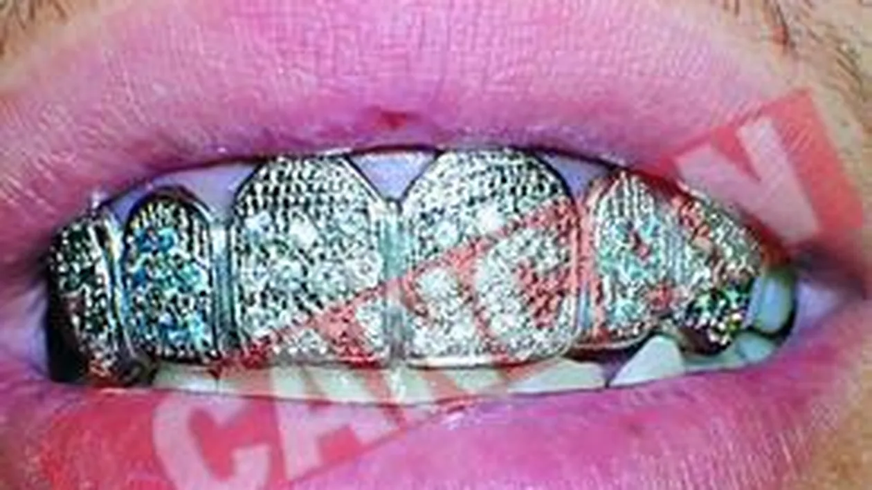 Bijuterii in loc de dinti, ultima moda printre vedete