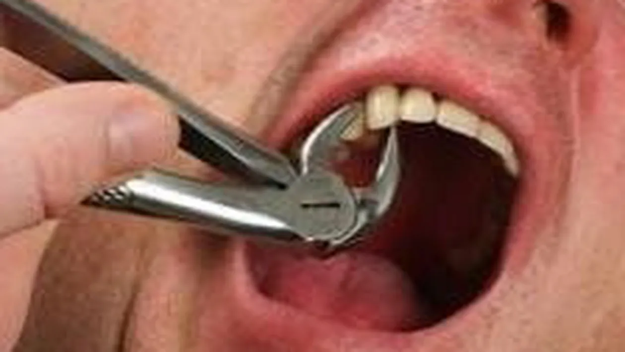 Eugen a murit după ce şi-a scos singur doi dinţi. Nu avea bani să meargă la dentist