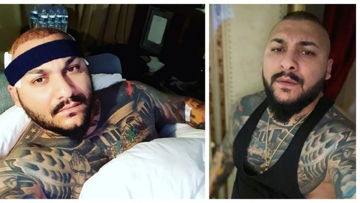 Să vezi și să nu crezi! Cum arată Dani Mocanu, după implantul de păr: „Ai dat banii de pomană, zici că ești...”