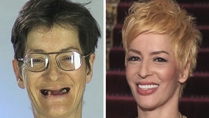 Cum arată acum LIGIA, femeia transformată total la "Frumuseţe pe muchie de cuţit"! A mai avut grijă de ea timp de 6 ani? Vedeţi mai bine fotografiile