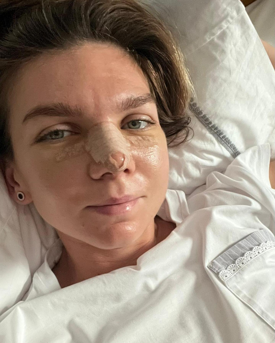 Simona Halep și-a schimbat total viața după divorț! Și-a făcut nas de păpușică, a renunțat la tenis pânâ în 2023, iar acum…