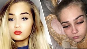 O copilă de 16 ani este ”prinsă” în corpul unei bătrâne de 80 de ani. Ce boală cumplită îi macină trupul