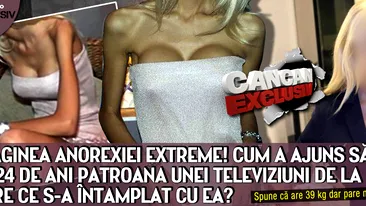 IMAGINEA ANOREXIEI EXTREME Cum a ajuns sa arate la 24 de ani patroana unei televiziuni de la noi! Oare ce s-a intamplat cu ea?