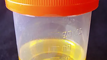 Au identificat un hot pe baza unei pungi cu urina!