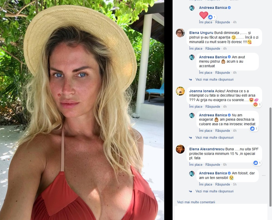 VIDEO / Soarele i-a prăjit pielea! Cum arată Andreea Bănică fără machiaj, după ce a uitat de crema de protecţie: „Pistruii şi-au făcut apariţia”. Cum a reacţionat la comentariile primite