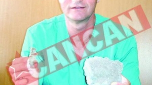 Colectioneaza pietre din rinichi