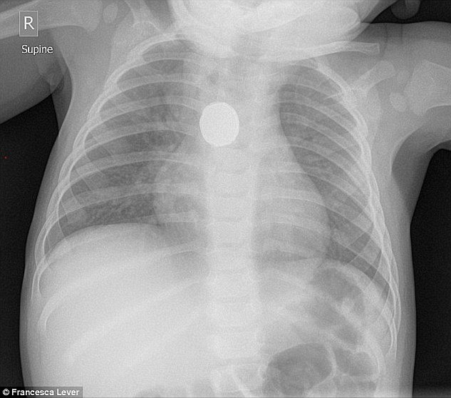 Imagine radiografie
