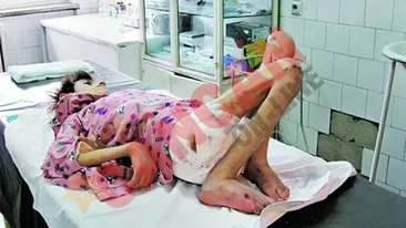 Cantareste 13 kilograme la 15 ani!