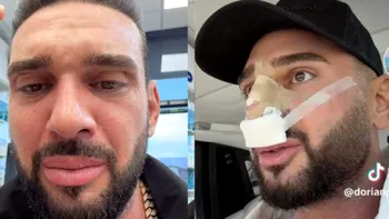 Ce probleme are Dorian Popa după operația la nas. Influencerul a recunoscut: „Nu-l simt așa încă al meu”