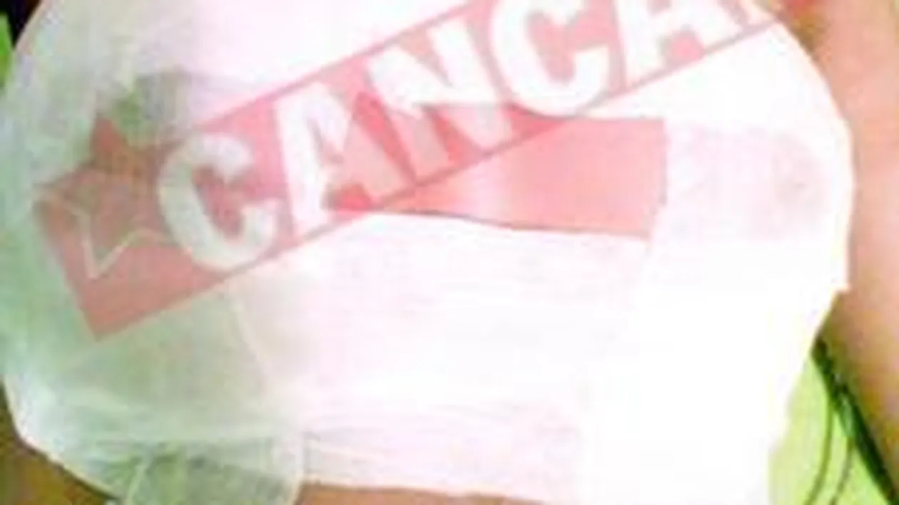 Si-a pus silicoane pe semnatura tatalui