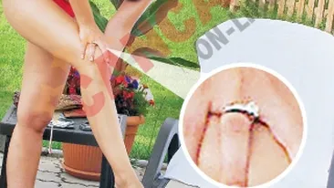 S-a logodit cu doctorul!