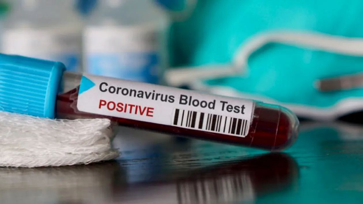 Coronavirus România. Numărul deceselor din cauza COVID-19 a ajuns la 469