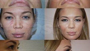 Adina Alberts: "Gina Pistol nu e obsedata de interventiile estetice" Uite cum arata iepurasul Playboy inainte si dupa operatii!