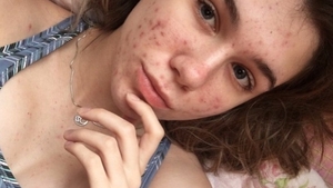 ”Când am ajuns în spital, mi s-a spus că mai am o zi până să orbesc” | Ce pastile luase de fapt fata! Atenție, ți se poate întâmpla și ție!