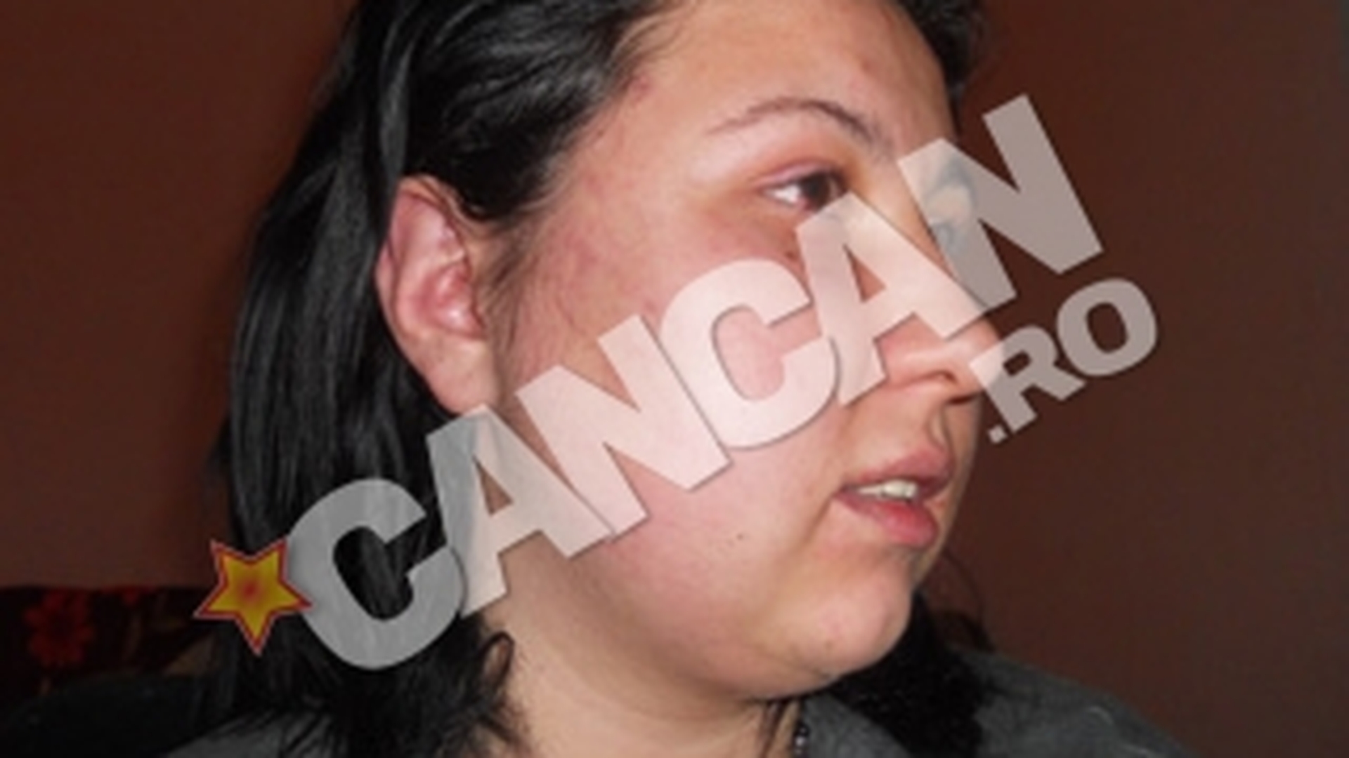 Ana Claudia, tanara care a sustinut ca s-a iubit cu cantareata Carmen Serban, a fost atacata de trei barbati!   „M-au drogat si m-au batut in fata blocului"
