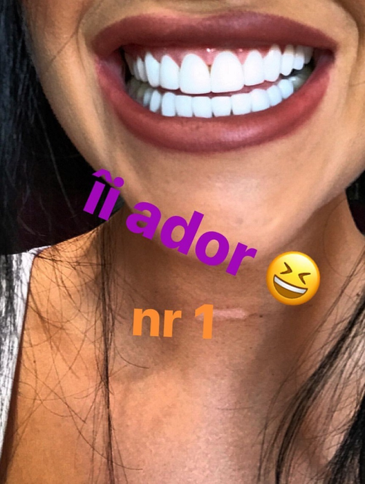 Daniela Crudu le-a arătat tuturor că are dinţii mai albi ca niciodată