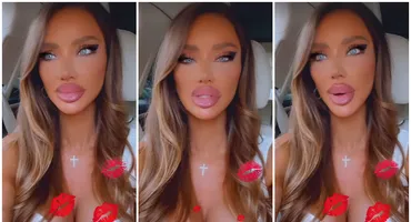 De ce își topește Bianca Drăgușanu acidul din buze. Vedeta a recunoscut ce s-a întâmplat