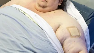 Avea 250 de kilograme si acum a ajuns la 90! Cum arata un roman dupa o asemenea transformare