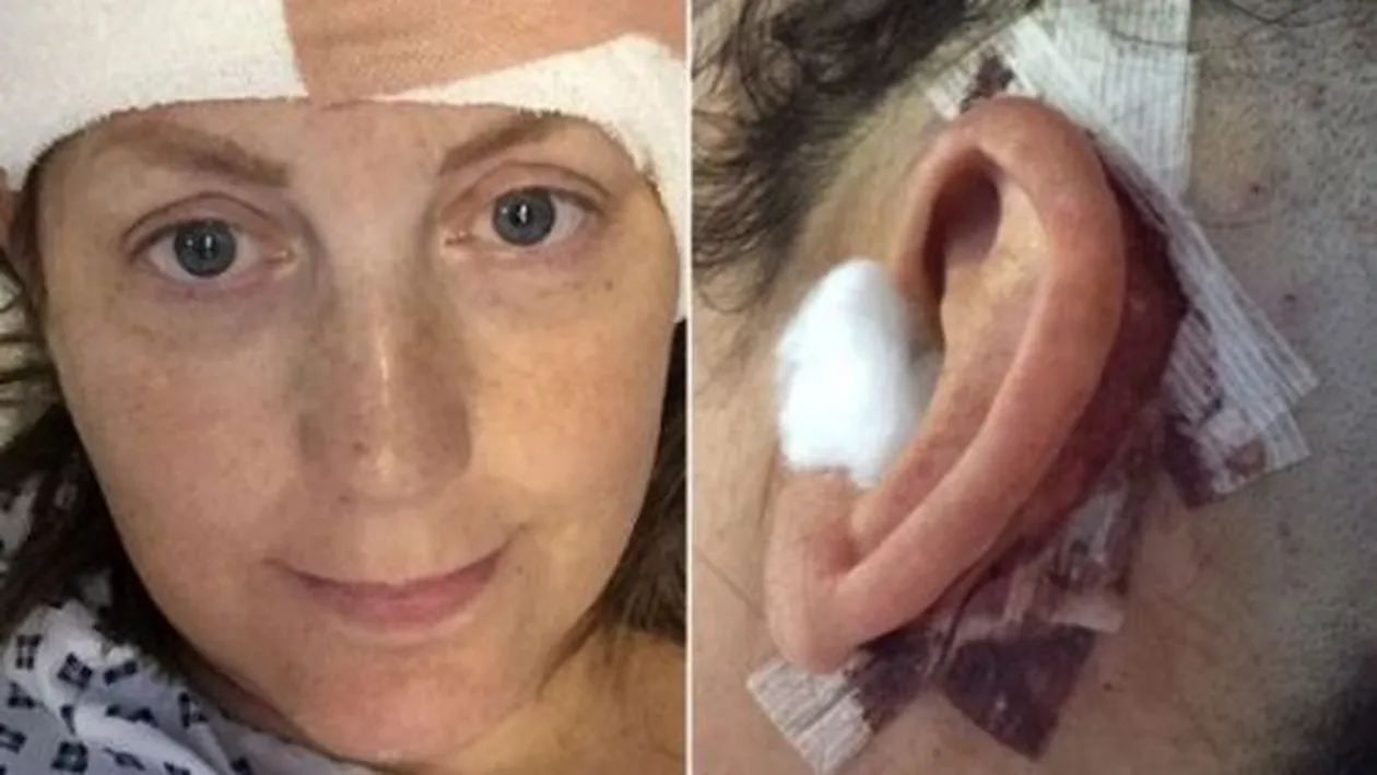 Femeia care își AUDE organele, zilnic. E torturată de sunetul ochilor când i se mișcă în cap