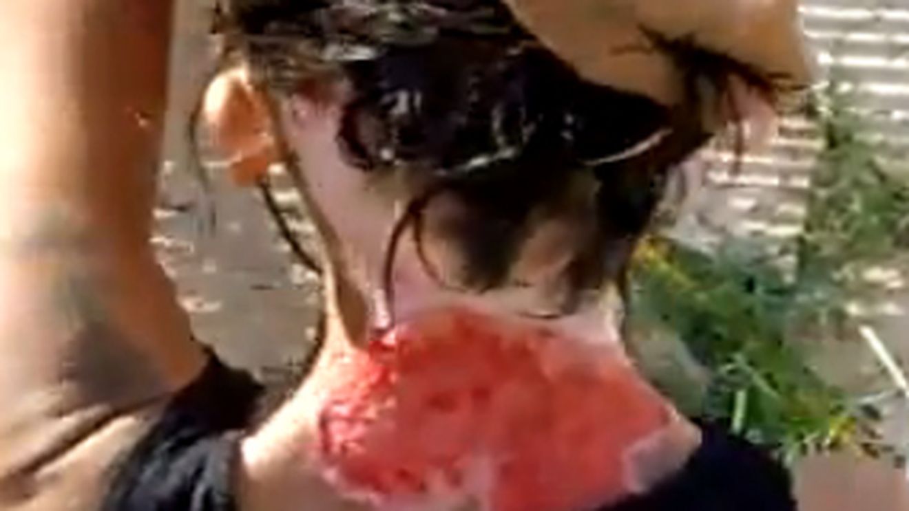 VIDEO Uite cum arata o drogata care s-a scarpinat pana la sange, dar spune ca a fost injunghiata