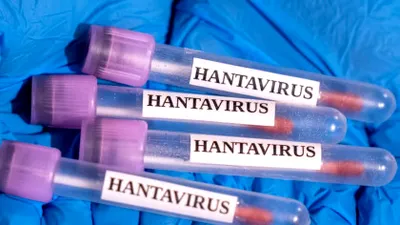 Hantavirusul este foarte diferit de COVID. Va provoca următoarea pandemie?