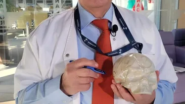 „3 din 5 persoane fac Alzheimer”. Profesorul Vlad Ciurea vorbește despre stilul de viață care influențează boala