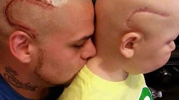 Un tată şi-a tatuat cicatricea fiului său de opt ani. Povestea care a emoţionat o lume întreagă
