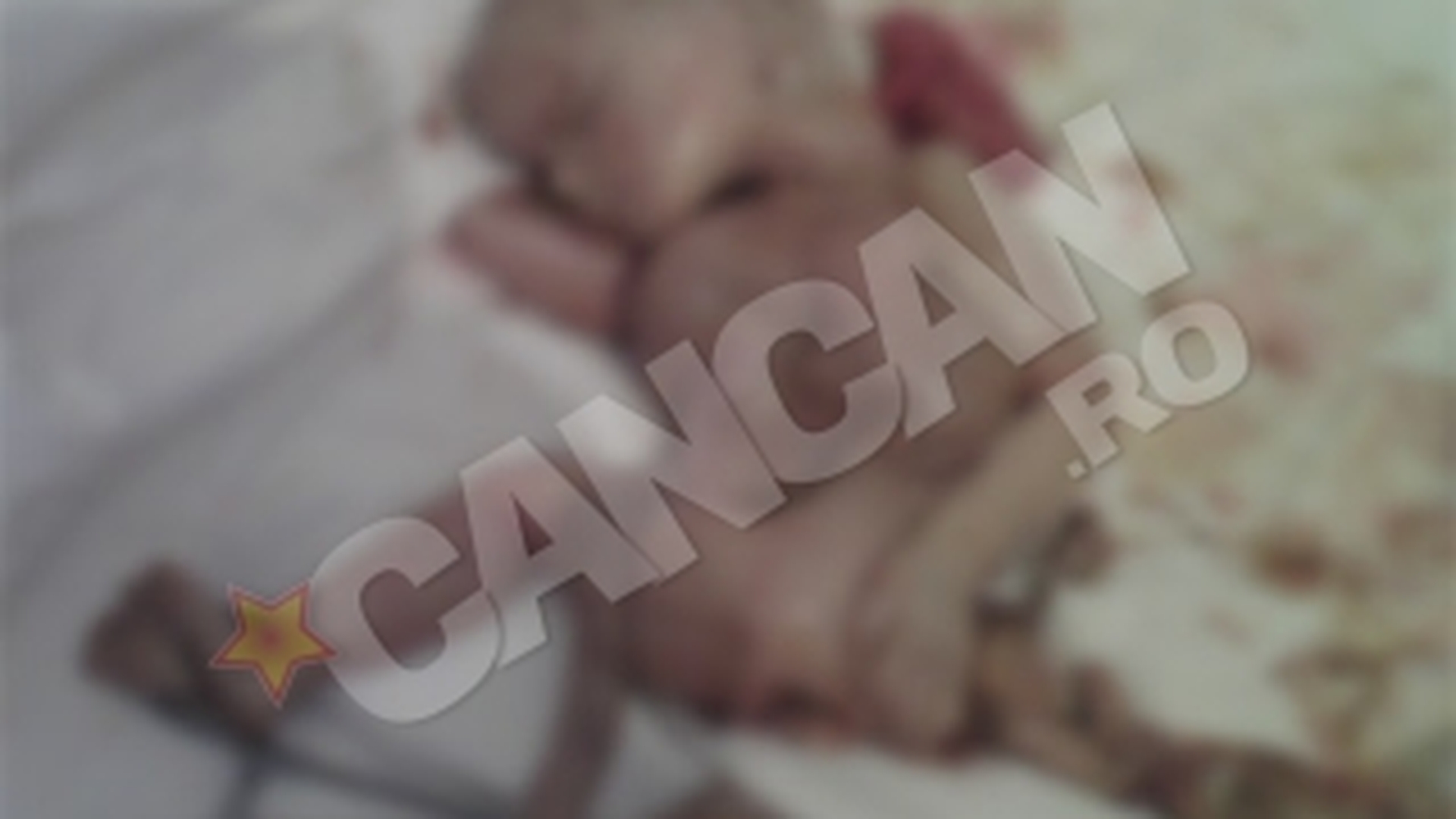 IMAGINI SOCANTE Caz foarte rar in lume! O femeie isi purta fatul mort de doua luni, in abdomen