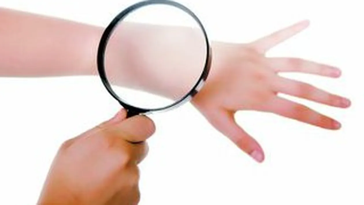 O Boala misterioasa produce rani ale pielii