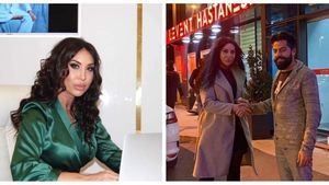 Legacy Med aduce în România inovație în transplantul de păr: implant de păr pentru femei fără a tunde podoaba capilară. Colaborare specială cu Turkey Hair Academy