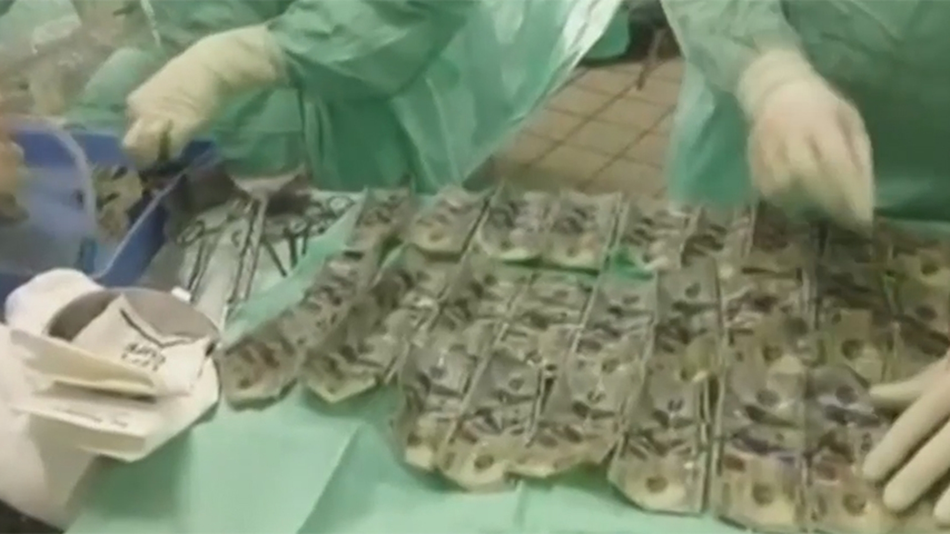 O femeie a înghiţit 7.000 de dolari! Motivul pentru care a recurs la acest gest şocant